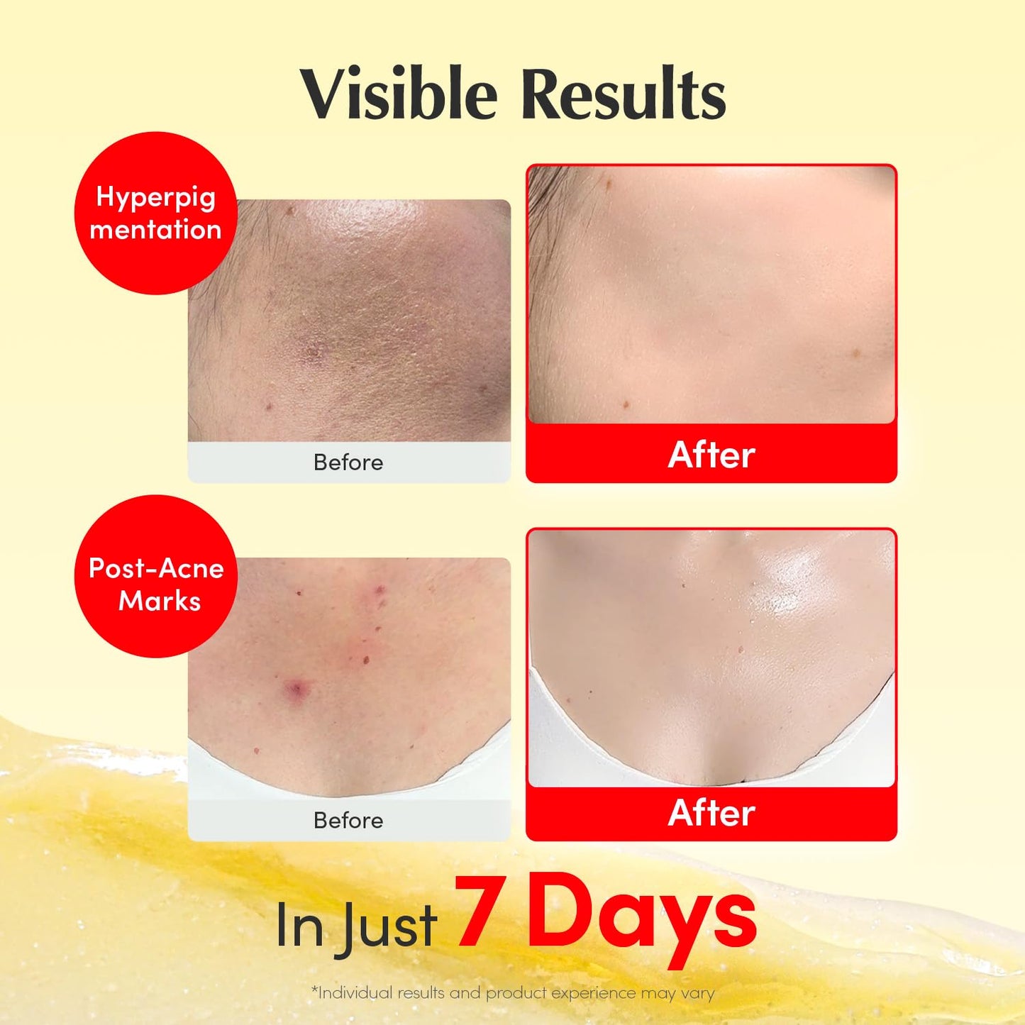 Vitamin Illuminating Cream – Vitamin C & 5% Niacinamide + 3% TXA | Dark spots Cream | Ceramide Barrier Strength | Glowy, Lightweight Hydration (1.69 fl.oz / 50ml)