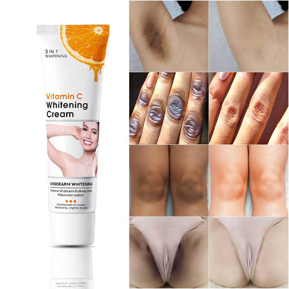Body VVhitening Cream for Private Area and Bikini Area, Quick Results Vitamin C Skin Care Cream (1.8 FL.Oz)
